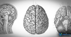 Historic Mental Health Treatments